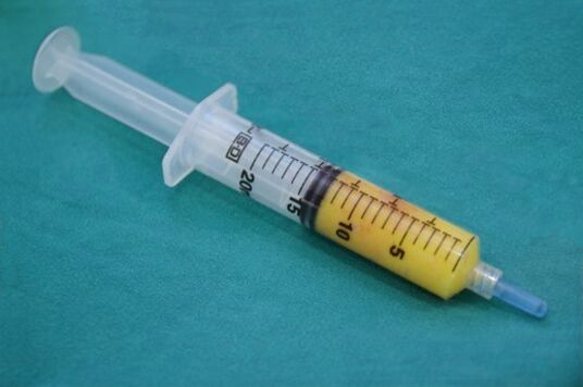 Siringa con tessuto adiposo per lipofilling